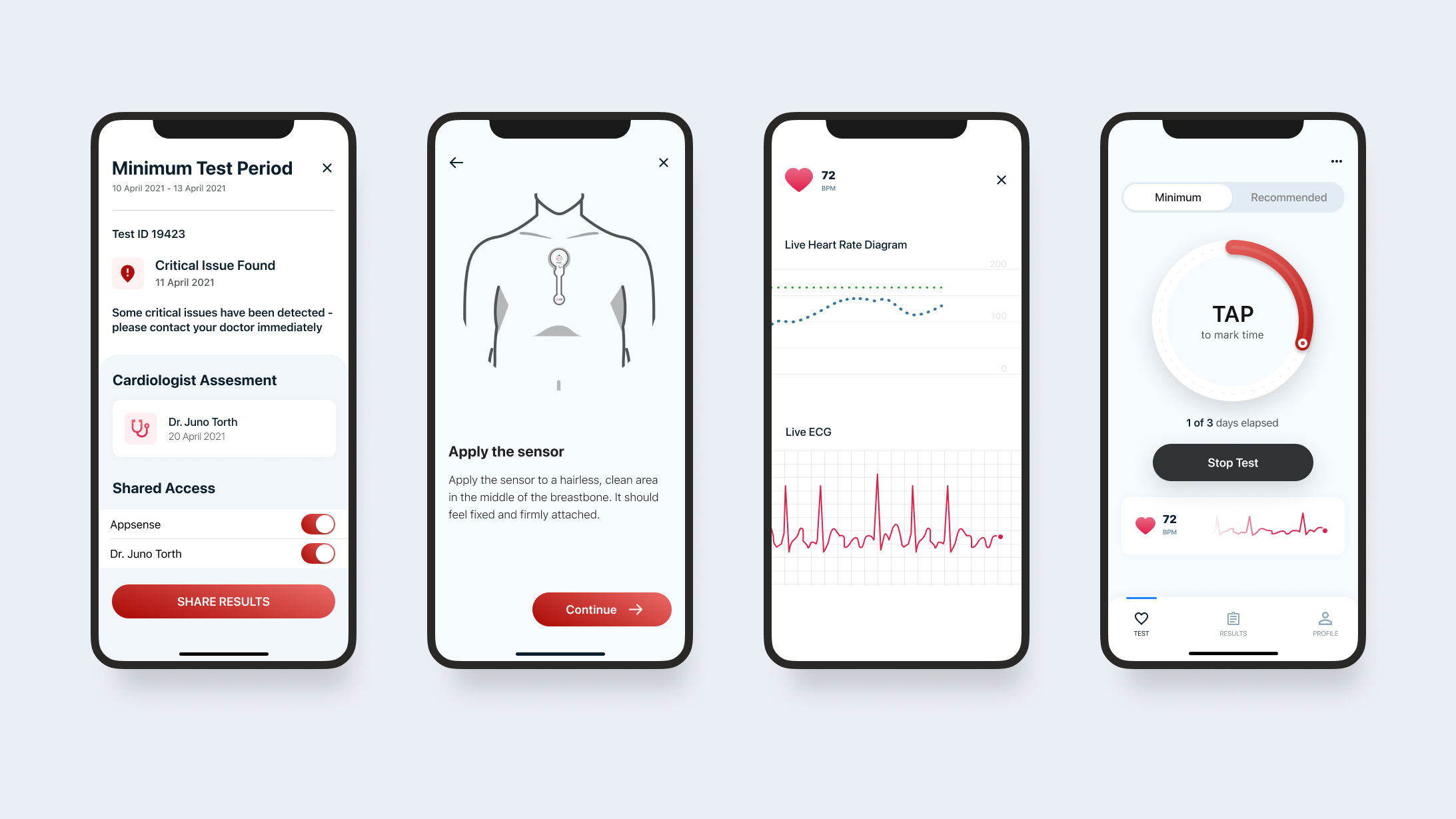 Skjermbilder fra ECG 247-appen — pasientgrensesnitt med visuell analyse.